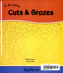 Cuts and Grazes cover