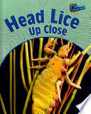 Head Lice up Close cover