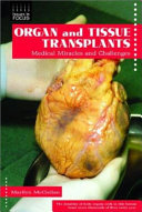 Organ and Tissue Transplants: Medical Miracles and Challenges cover