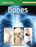 Bones cover