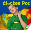 Chicken Pox cover