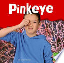 Pinkeye cover
